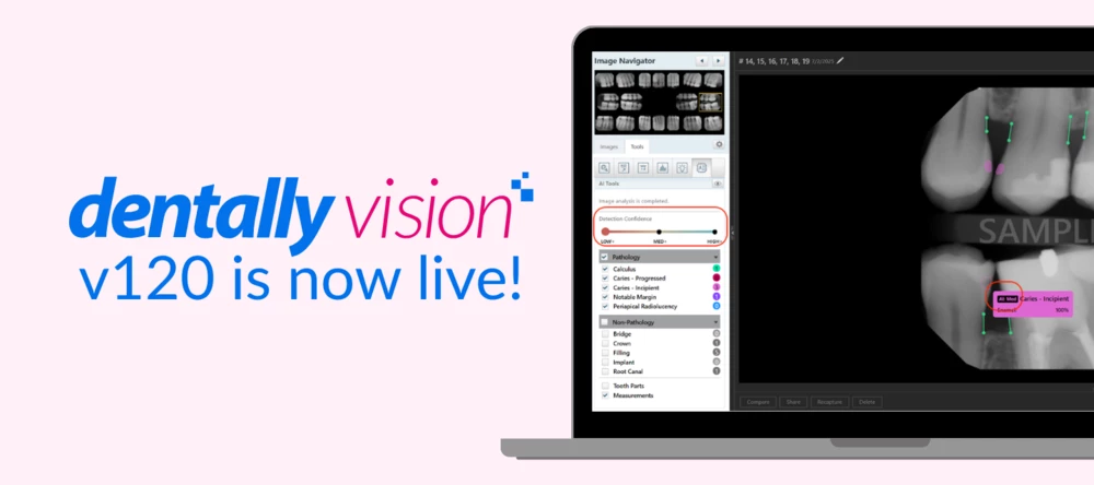 🚀 Dentally Vision v120 is Live! What’s New | Community